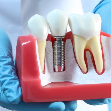 Why Might Dental Implants Be the Right New Year’s Resolution for You?